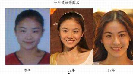 **整容前后的样子!好丑 - 非主鬼 - 屎之家!