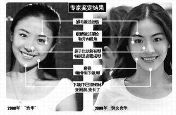 **整容前后的样子!好丑 - 非主鬼 - 屎之家!