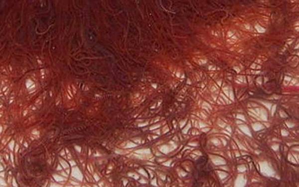 红线虫是什么动物?