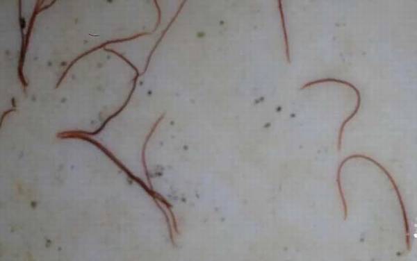 红线虫是什么动物?