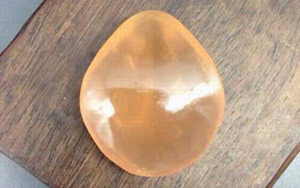 青鱼石在鱼的什么部位?