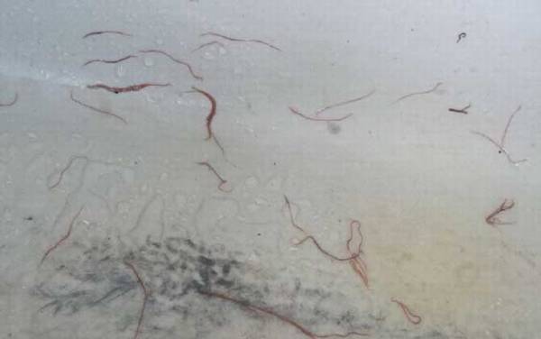 红线虫会钻进人体吗?