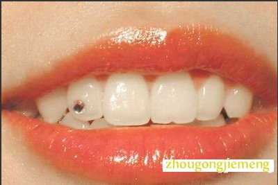 梦见牙掉了 牙齿掉了