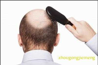 梦见担心丈夫掉头发