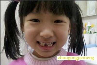 �������ε���