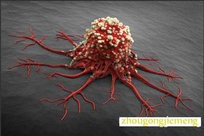 梦见癌症 得癌症